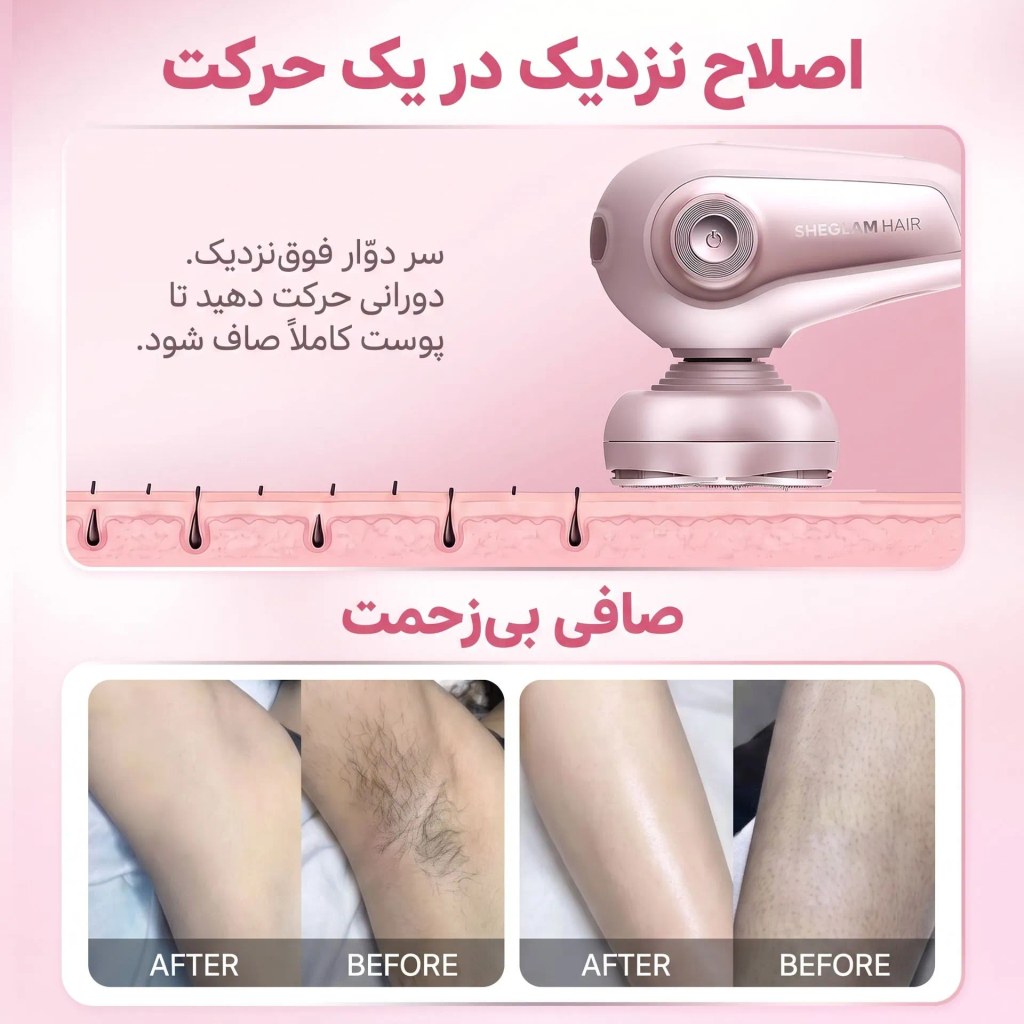 اصلاح نزدیک در یک حرکت با شیور ۵ بعدی شیگلم و نتایج قبل و بعد