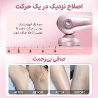 اصلاح نزدیک در یک حرکت با شیور ۵ بعدی شیگلم و نتایج قبل و بعد