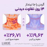 نمودار تغییرات خطوط عمیق و ریز گردن پس از ۱۴ روز استفاده از کرم