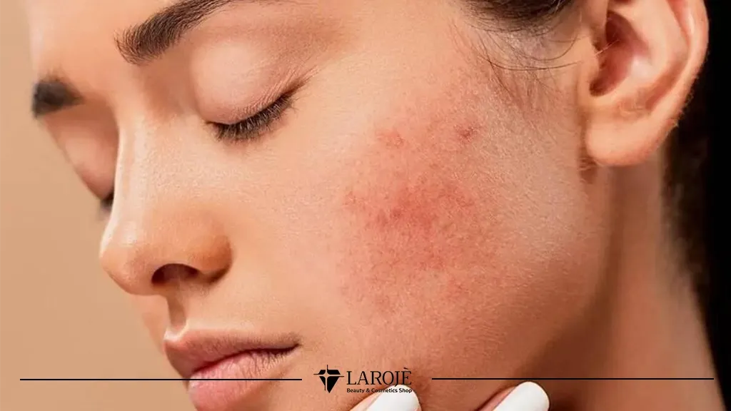 Cerave یا اوردینری