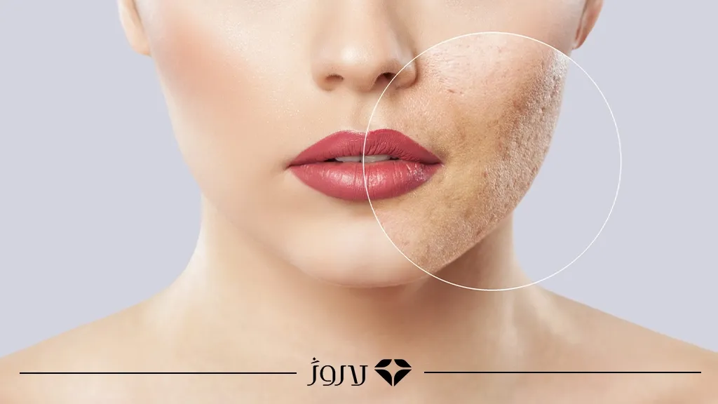 آرایش مخصوص پوست دارای اسکار
