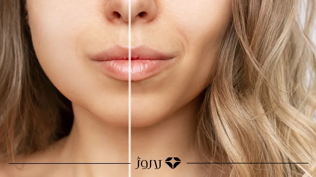 چال گونه با آرایش چیست و چرا محبوب شده است؟