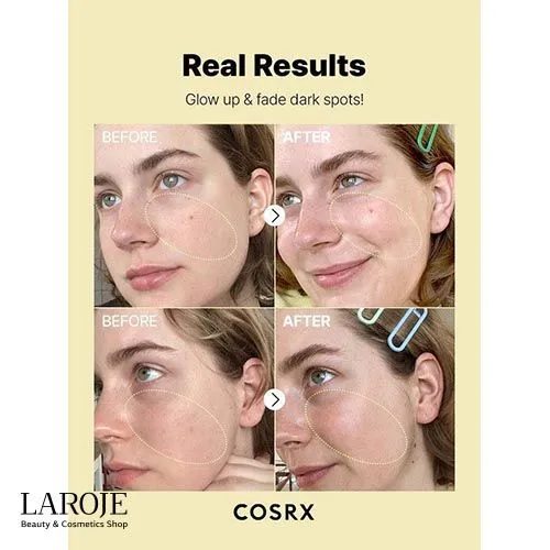 سرم ضدلک و روشن کننده ویتامین سی 23% کوزارکس Cosrx - تصویر ۶ سرم ضدلک و روشن کننده ویتامین سی 23% کوزارکس Cosrx - تصویر ۶