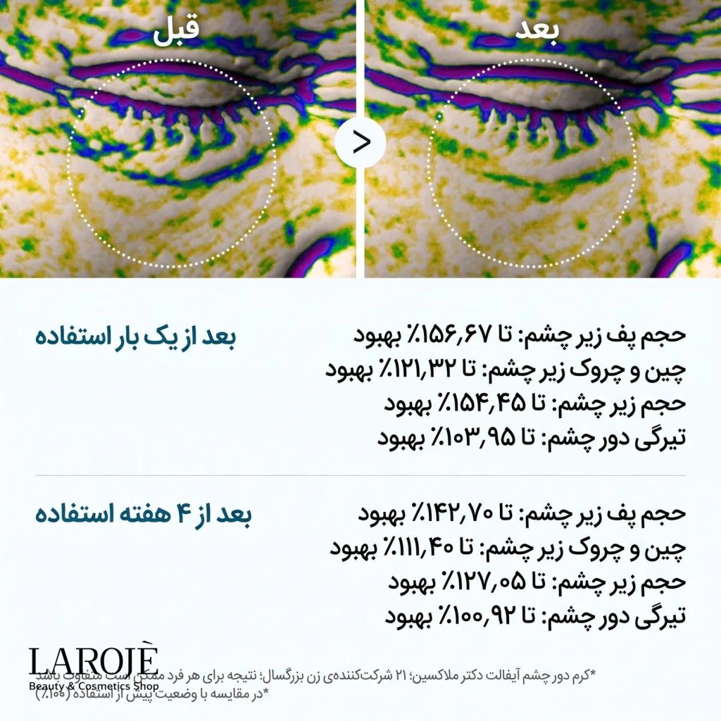نتایج آزمون بالینی کرم دور چشم Eyephalt بعد از یک بار و چهار هفته استفاده