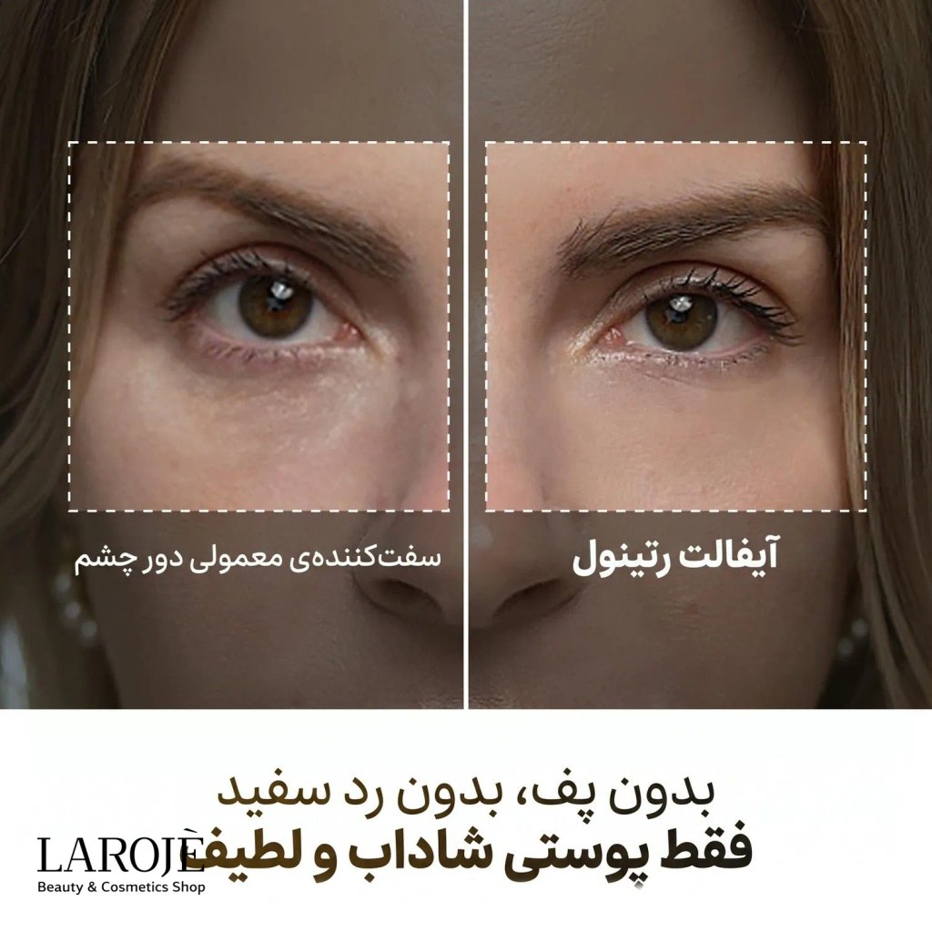 مقایسه‌ی سفت‌کننده‌ی معمولی دور چشم با کرم دور چشم رتینول Eyephalt