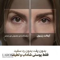 مقایسه‌ی سفت‌کننده‌ی معمولی دور چشم با کرم دور چشم رتینول Eyephalt