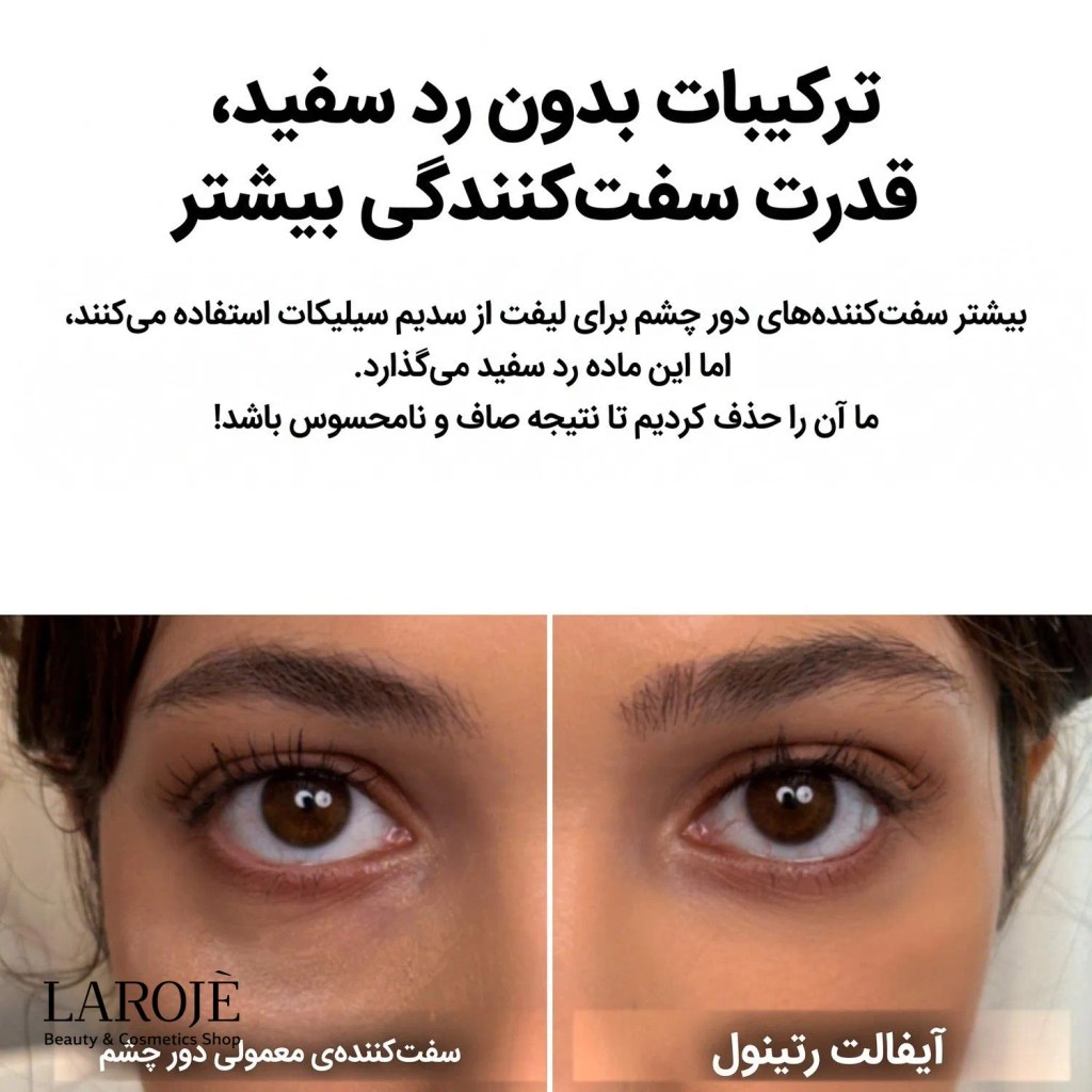 ترکیبات بدون رد سفید کرم دور چشم رتینول Eyephalt دکتر ملاکسین
