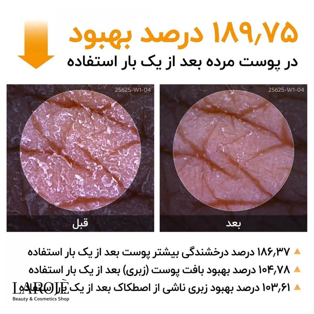 نتیجه‌ی آزمون بالینی اسپری Peel Shot در کاهش پوست مرده بعد از یک بار استفاده