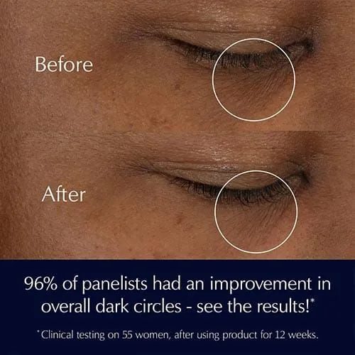 کرم دور چشم استی لادر Estee Lauder مدل Advanced Night Repair - تصویر ۷ کرم دور چشم استی لادر Estee Lauder مدل Advanced Night Repair - تصویر ۷