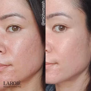 کرم ترمیم کننده سیکاپلاست لاروش پوزای La Roche Posay - تصویر ۴