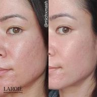 کرم ترمیم کننده سیکاپلاست لاروش پوزای La Roche Posay - تصویر ۴