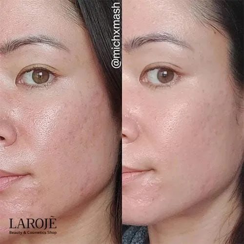 کرم ترمیم کننده سیکاپلاست لاروش پوزای La Roche Posay - تصویر ۴