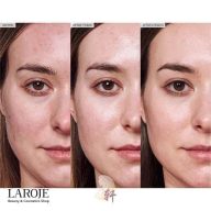 کرم ترمیم کننده سیکاپلاست لاروش پوزای La Roche Posay - تصویر ۵