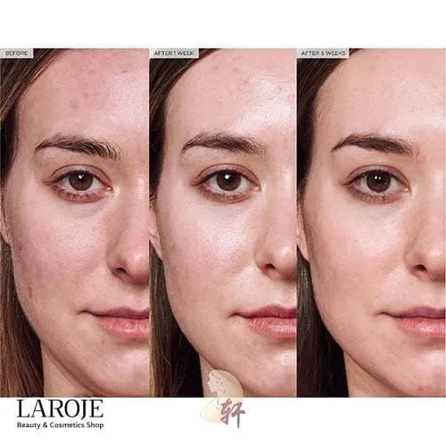 کرم ترمیم کننده سیکاپلاست لاروش پوزای La Roche Posay - تصویر ۵