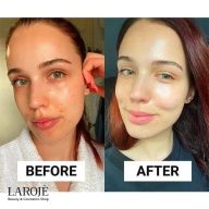 کرم آبرسان و ضدجوش لاروش پوزای La Roche Posay با SPF30 - تصویر ۴