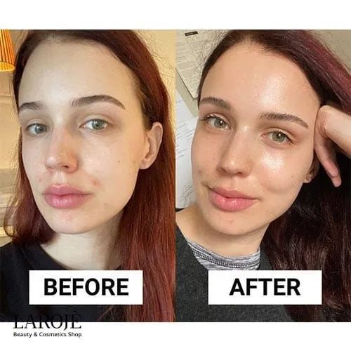 کرم آبرسان و ضدجوش لاروش پوزای La Roche Posay با SPF30 - تصویر ۳ کرم آبرسان و ضدجوش لاروش پوزای La Roche Posay با SPF30 - تصویر ۳