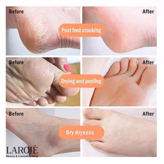 ماسک لایه بردار پا پیوردرم Purederm - تصویر ۴