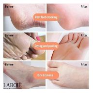 ماسک لایه بردار پا پیوردرم Purederm - تصویر ۴