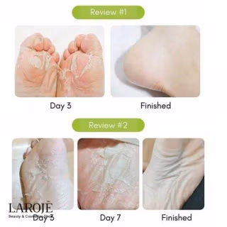 ماسک لایه بردار پا پیوردرم Purederm - تصویر ۳
