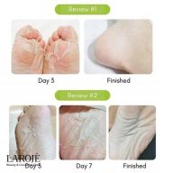 ماسک لایه بردار پا پیوردرم Purederm - تصویر ۳